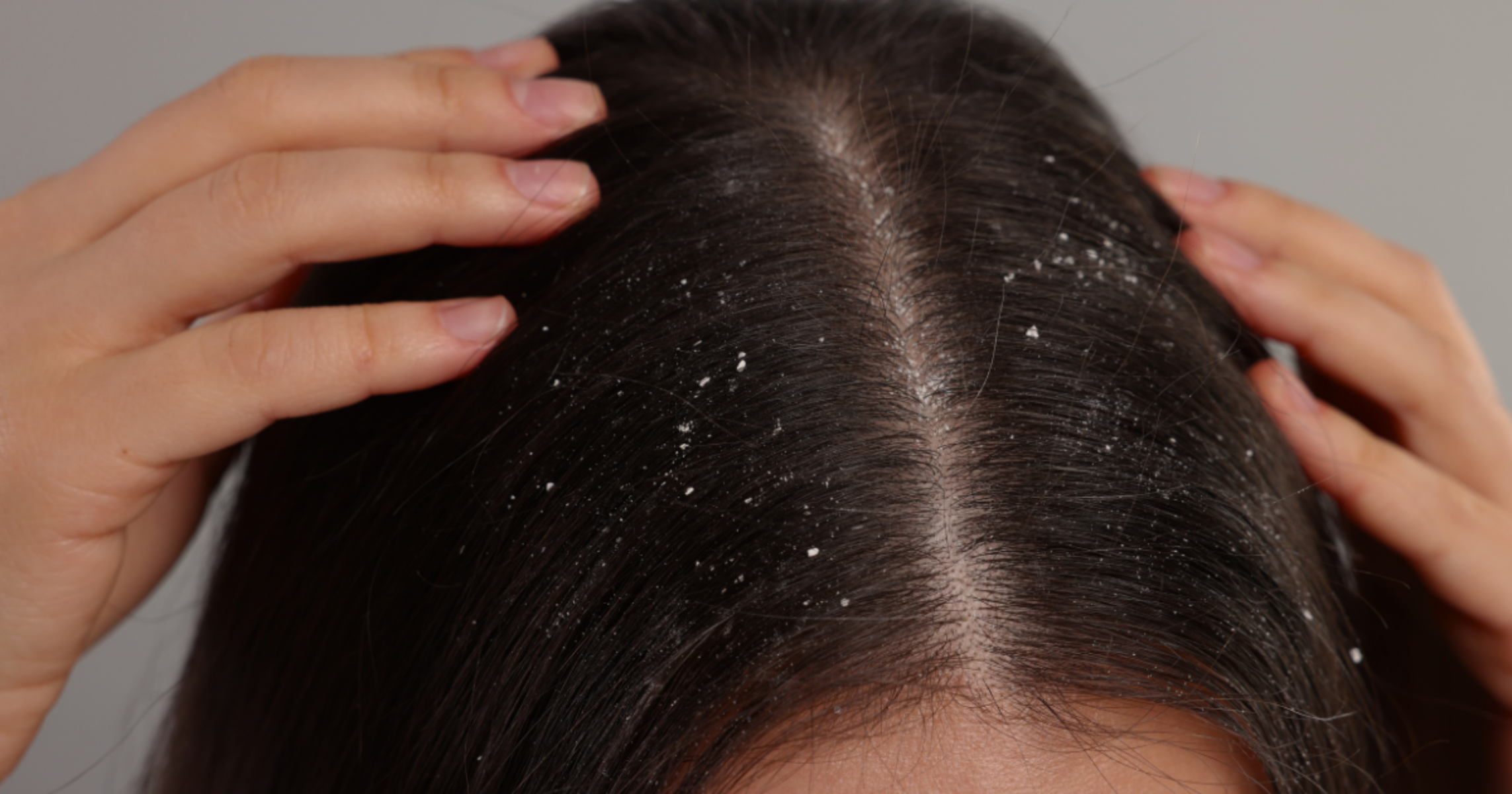 Baxmanns Holistic Head Care
